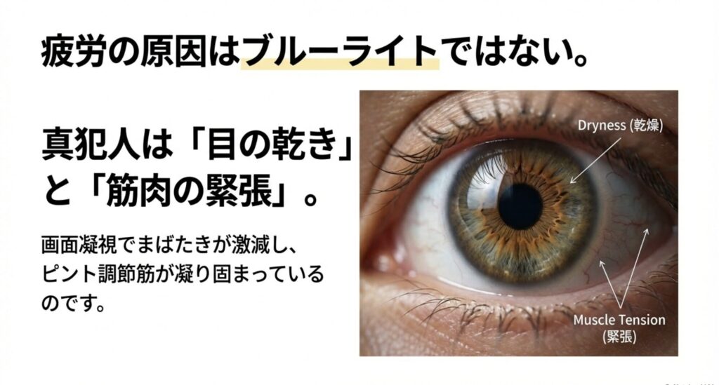 眼精疲労の原因（DrynessとMuscle Tension）を解説した目の解剖図スライド