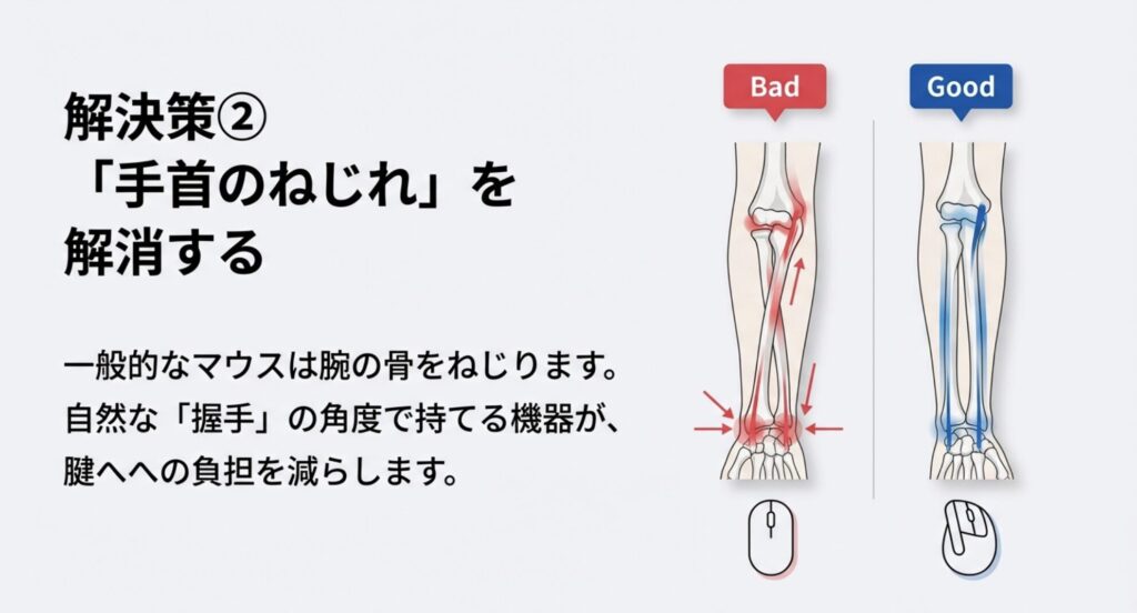 一般的なマウス操作時に腕の骨がねじれて手首や腱に負担がかかる仕組みの図解